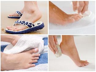the fungus of the skin of the feet prevention