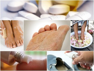 the fungus of the skin of the feet remedies