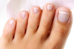 nail fungus of the feet